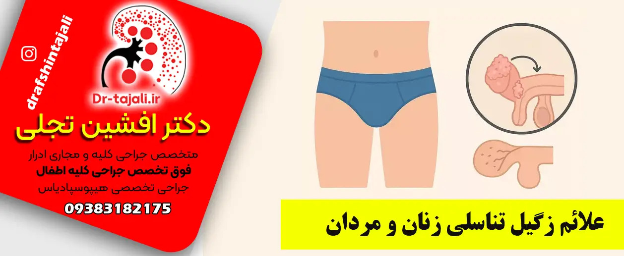 مرکز درمان زگیل تناسلی در اصفهان